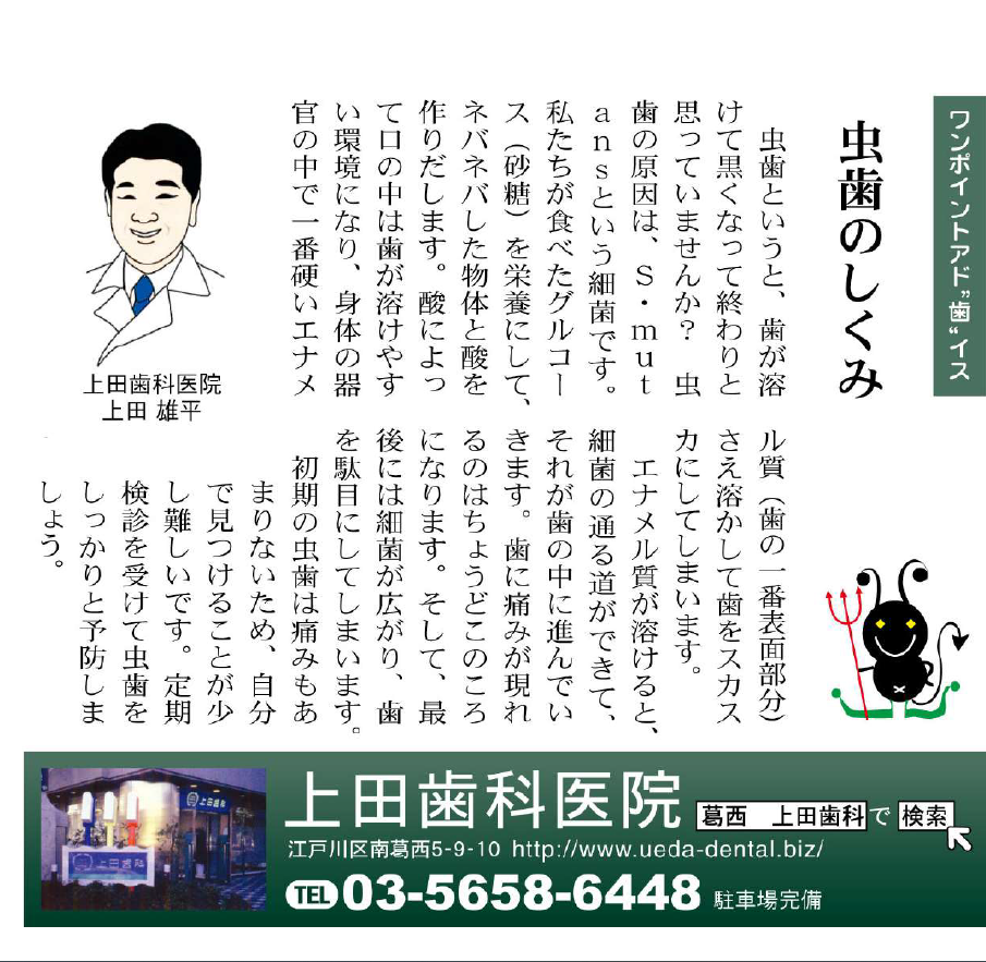 虫歯のしくみ