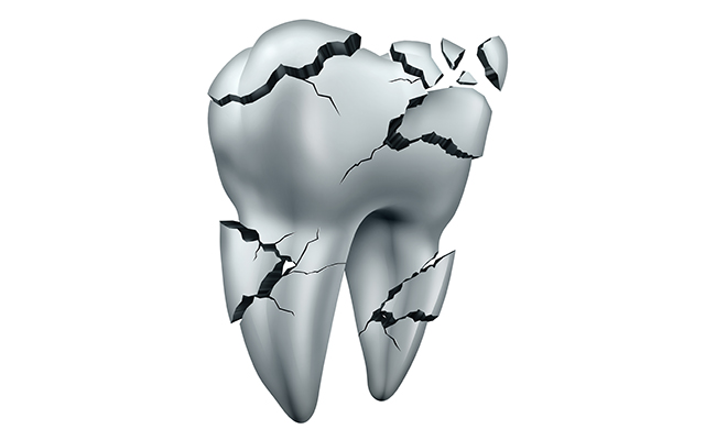 土台となる骨を溶かす歯周病