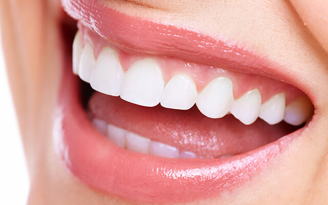 白い歯はあなたの印象を変えます